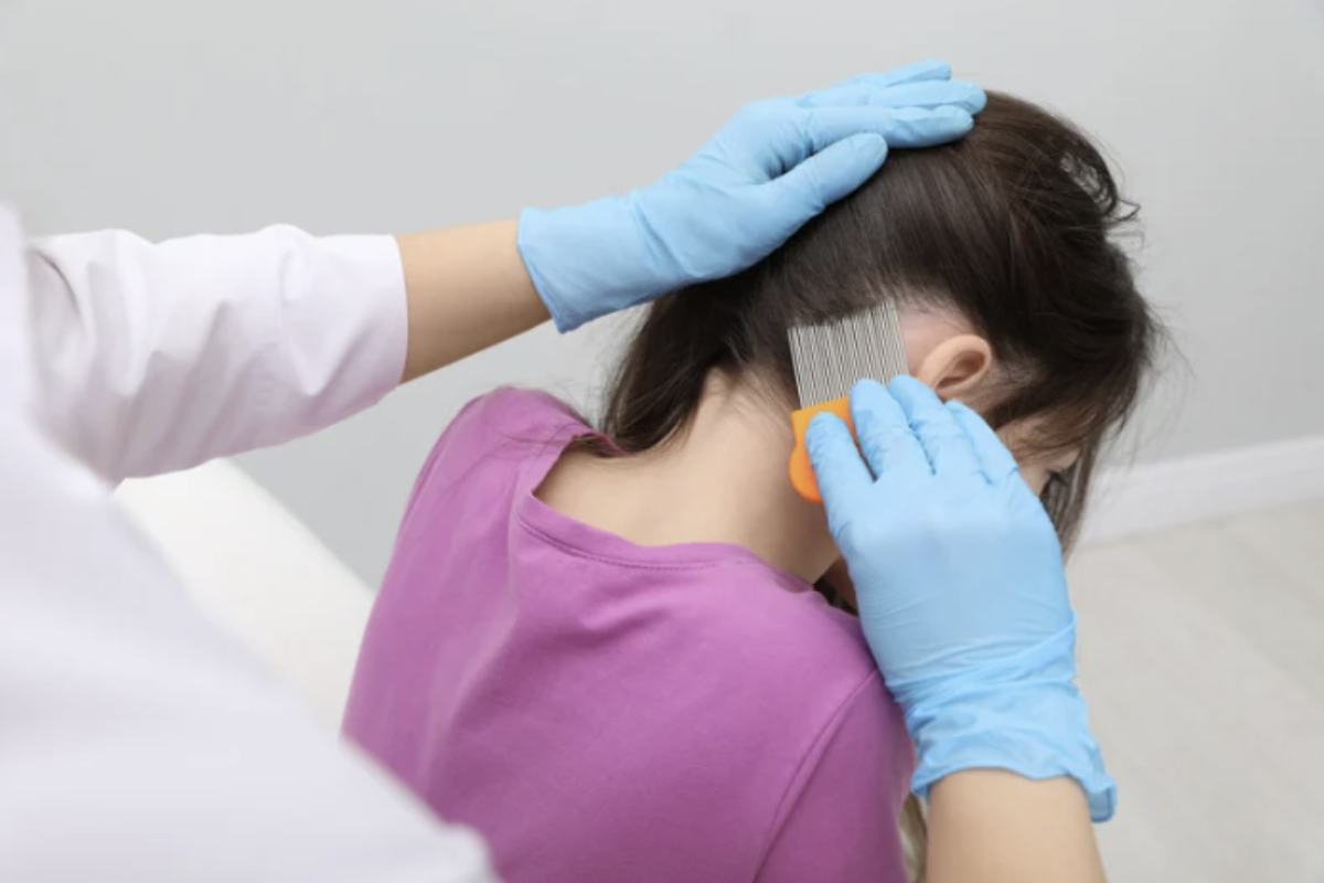 Sconfiggere i pidocchi richiede costanza, metodo e un approccio integrato. Ecco le buone prassi consigliate dagli esperti