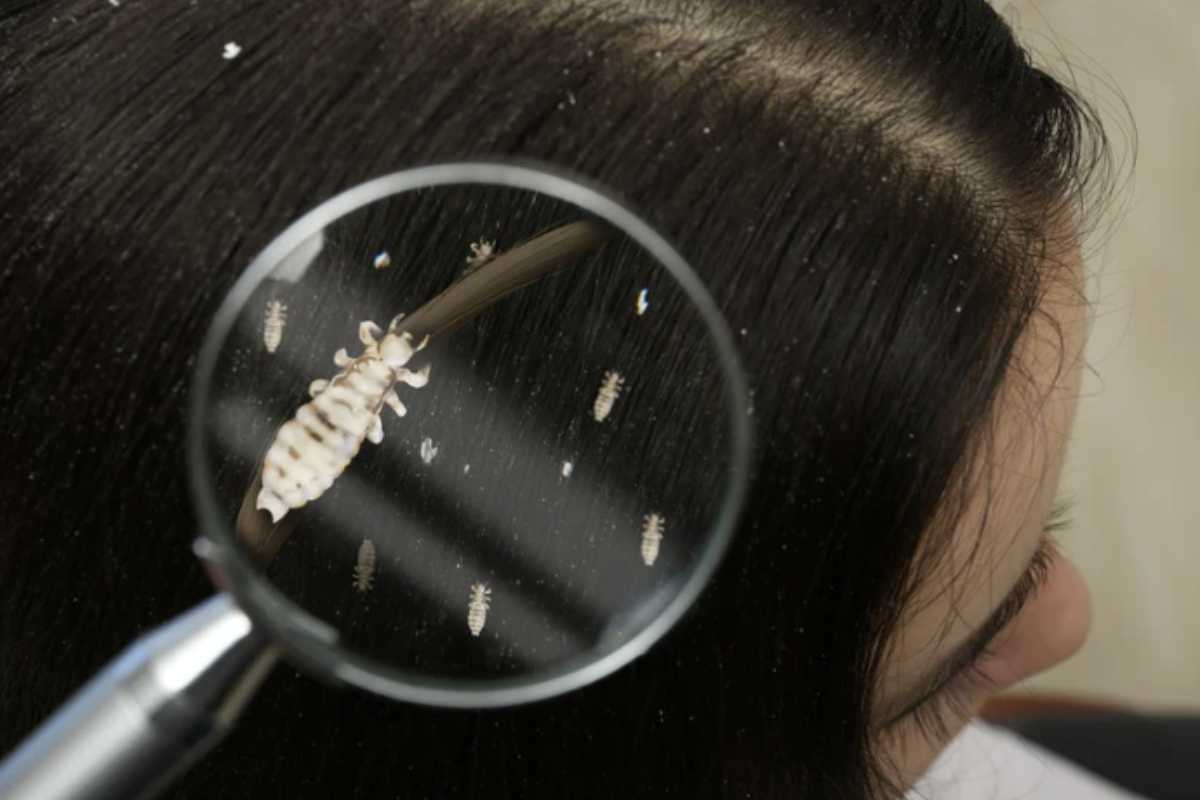 Nonostante l’ampia disponibilità di prodotti specifici e rimedi casalinghi, le reinfestazioni sono frequenti a causa di alcuni errori comuni nel trattamento